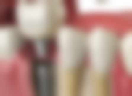 浙江宁波佳宁口腔门诊部核心项目