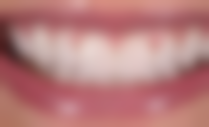 王金凤技术水平评价