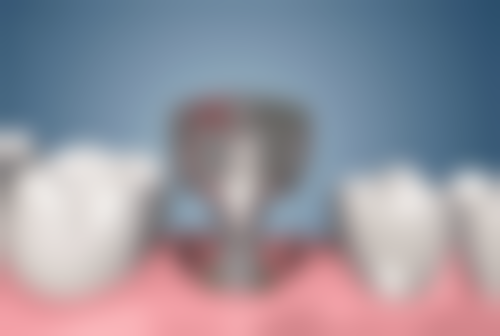 宁夏银川美维口腔诊所核心项目