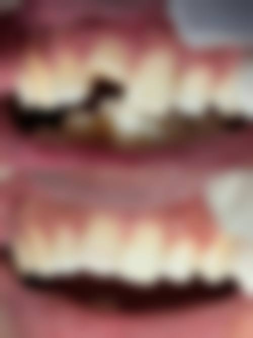 深圳河山口腔门诊部怎么预约？