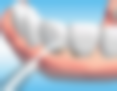 中山刘立琴口腔诊所实例参考