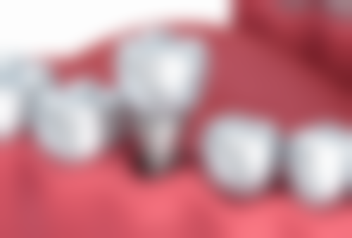 浙江绍兴新昌爱齿口腔实例参考