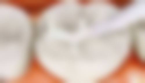 永州悦莱口腔医院价格表（仅供参考）