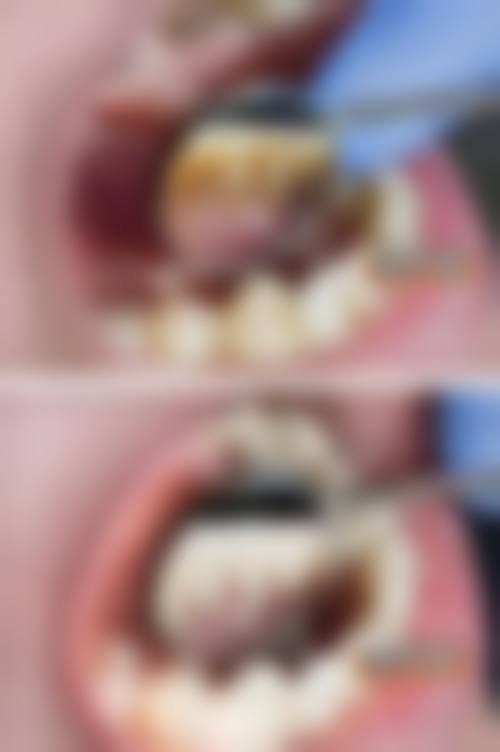 成都双流海贝口腔门诊部核心项目