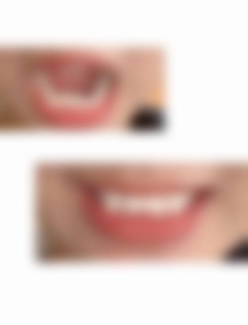 胡煜恒患者评价