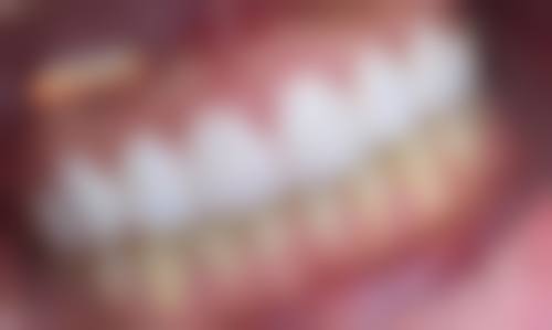 深圳拜博口腔(车公庙店)实例参考