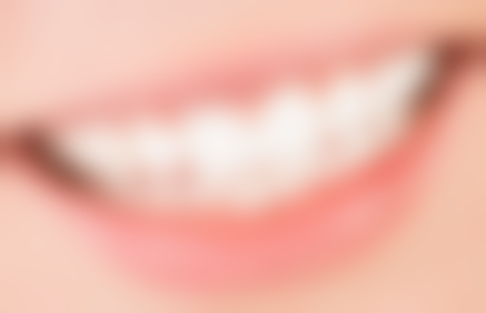 山东威海荣成银鹏口腔实例参考