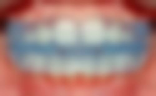 徐州一诺口腔门诊部核心项目