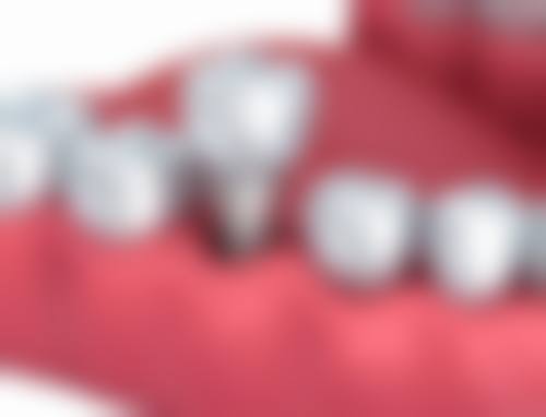 青岛赛思博正胶州赛思口腔实例参考