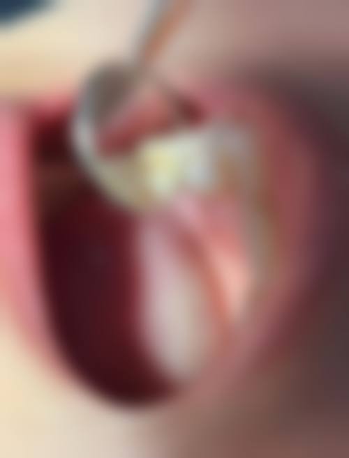 保山施甸博盛口腔诊所价格表（仅供参考）