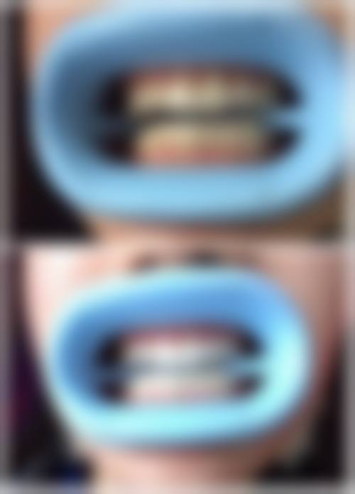 海南海口莱美俪格口腔怎么预约？