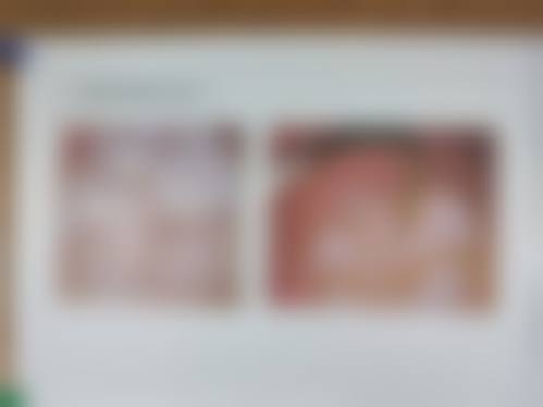 青岛赛思博正胶州赛思口腔价格表（仅供参考）