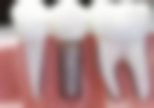 山东潍坊昌乐李金玉口腔收费标准