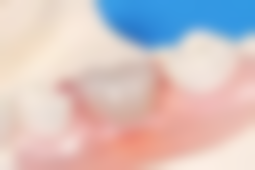 广州德仁口腔实例参考