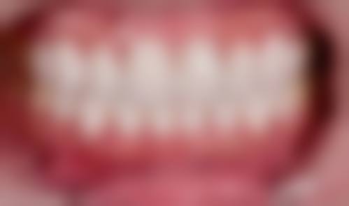 共昌口腔门诊部（洞庭路店）价格表（仅供参考）