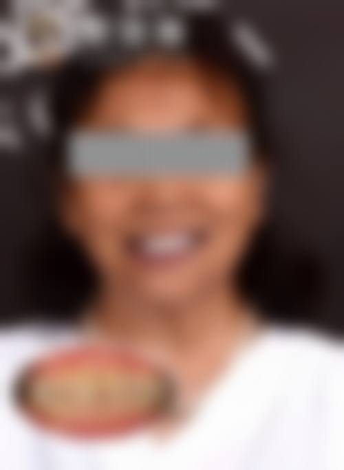 山东潍坊昌乐李金玉口腔正规吗？看资质