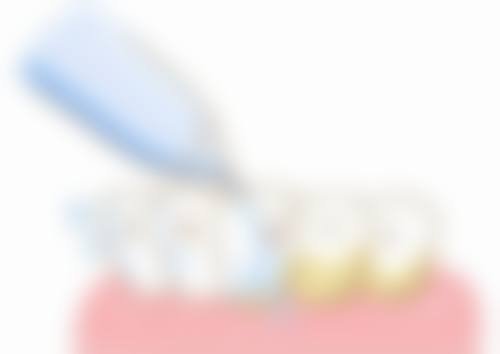 清远源镁联合口腔门诊部核心项目