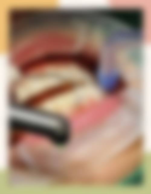 贵州黔西兴仁鑫侬口腔核心项目