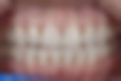 陕西安康汉滨区牙一生口腔核心项目