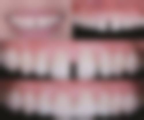 山东济南历城李严口腔实例参考