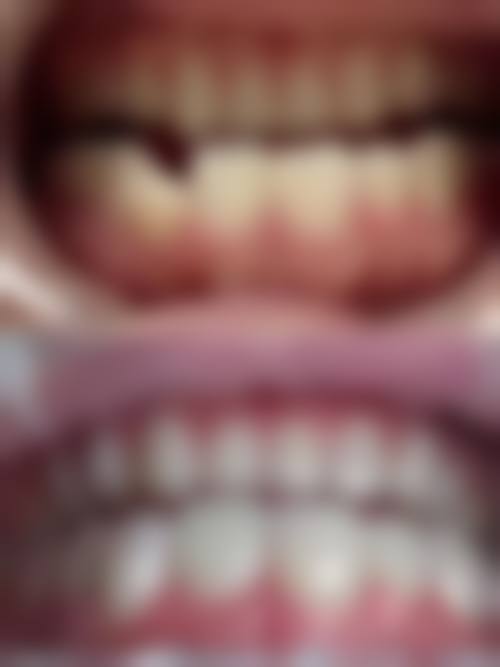 陕西安康汉滨区牙一生口腔价格表（仅供参考）