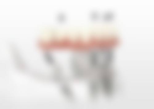 昆明艺博口腔价格表（仅供参考）