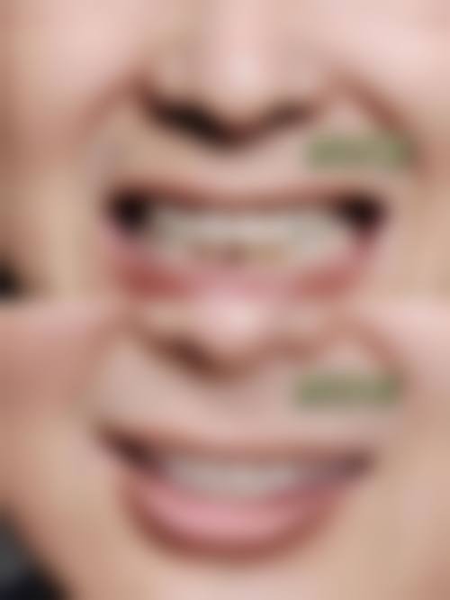 乳山明珠口腔价格表（仅供参考）