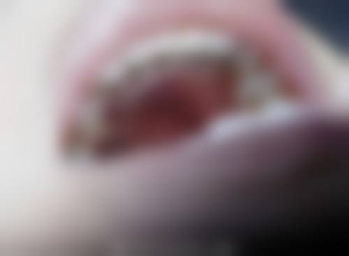 深圳佳美口腔医院怎么预约？