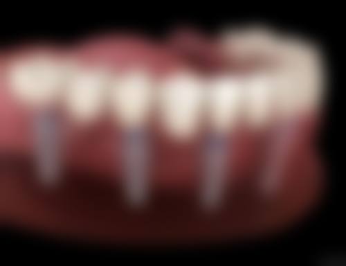 杭州艺星湖滨口腔诊所怎么预约？