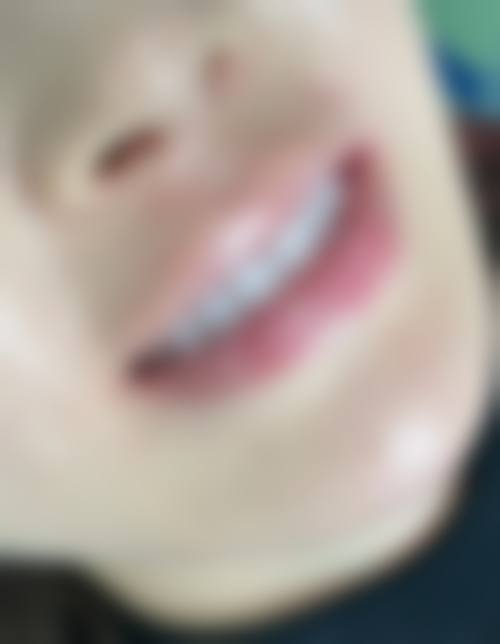 山西晋中刘双全口腔连锁怎么预约？