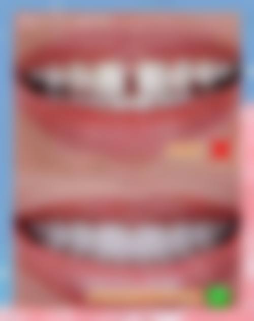 广东东莞伢博仕口腔南栅实例参考