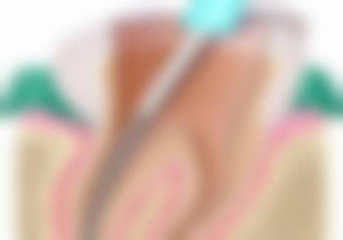 山东潍坊临朐曾凡云口腔实例参考