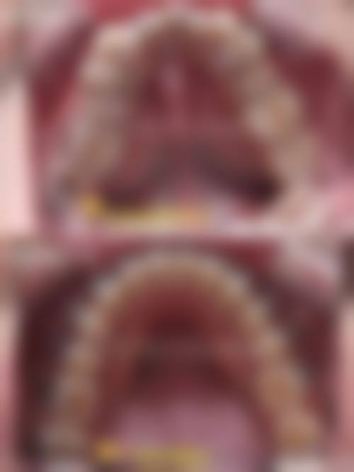 泰安万洁口腔怎么预约？