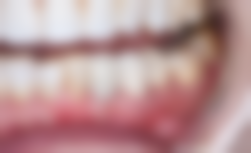 成都金琴口腔门诊部价格表（仅供参考）