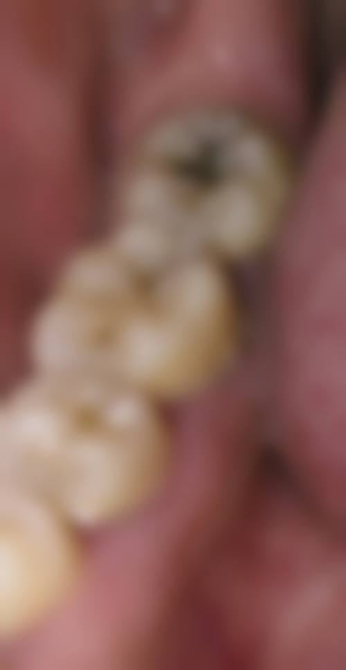 蒙自胡氏（瑞豪）口腔门诊部价格表（仅供参考）