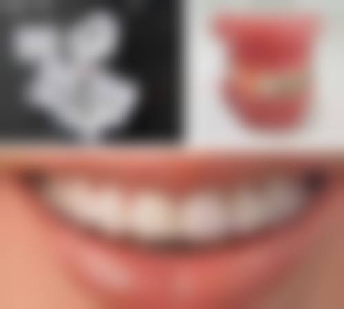 山东淄博临淄光明口腔诊所核心项目