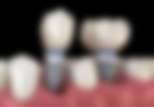 上海苏菲口腔怎么预约？