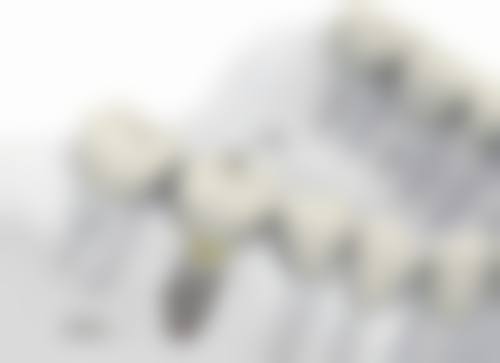 福州松鼠口腔门诊部价格表（仅供参考）