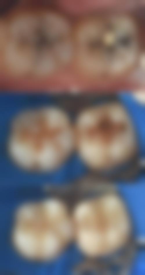 湖北襄阳罗丹口腔诊所价格表（仅供参考）