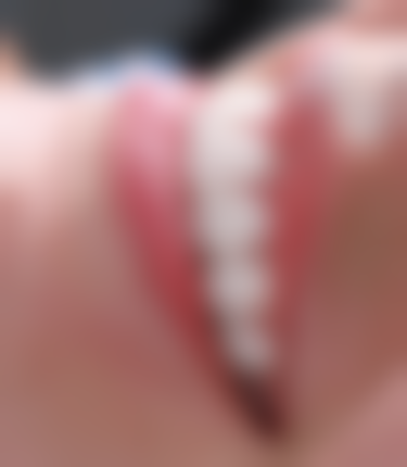 浙江杭州施国美口腔怎么预约？