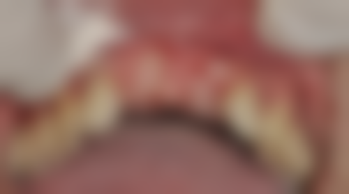 江苏扬州葛绍霞口腔门诊部核心项目