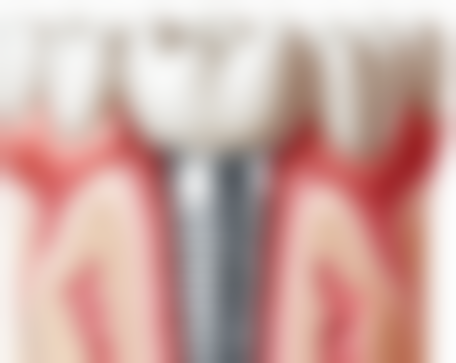 李群擅长项目列表