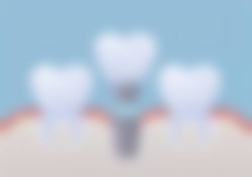 山东威海健威口腔医院2026价格表参考