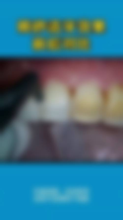 成都武侯惠美口腔诊所2026价格表参考