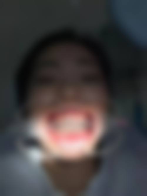 山东威海健威口腔医院口碑评价