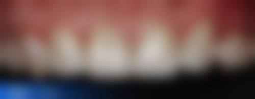 无锡华云口腔技术设备怎么样？