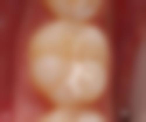 博美口腔门诊部(景芳路店)擅长项目有哪些?