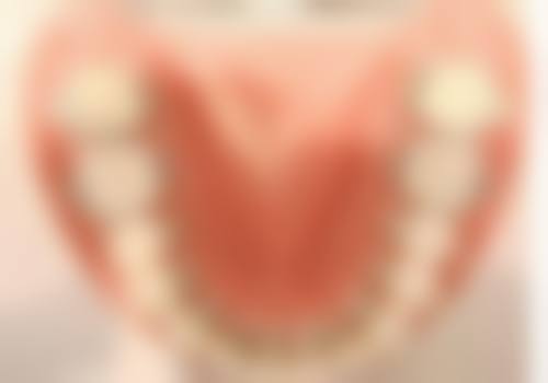 深圳博润口腔医生团队解析