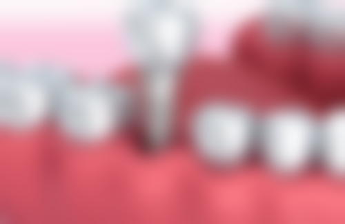 南昌泰康拜博口腔医院2026价格表参考