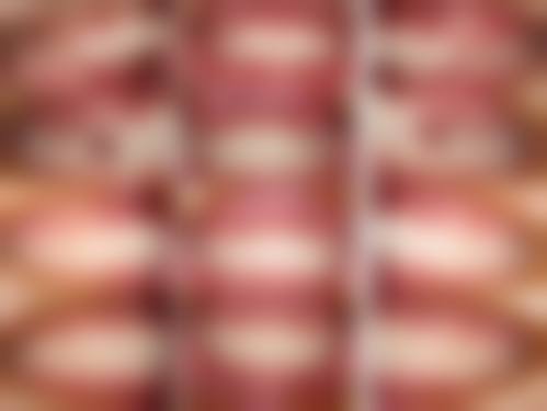 云南大学附属医院口腔医学中 心(口腔正畸科)医生团队解析